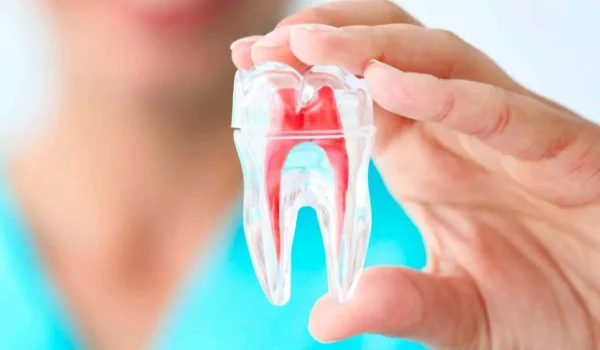 Endodontia-1200x675-1